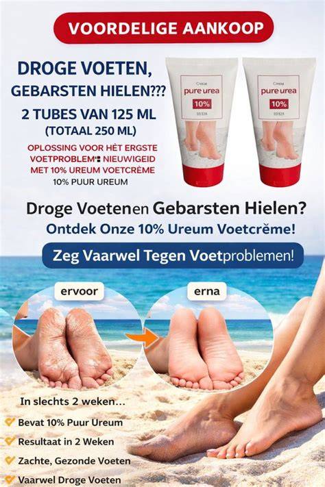 Voetcrème aanbrengen op droge hielen