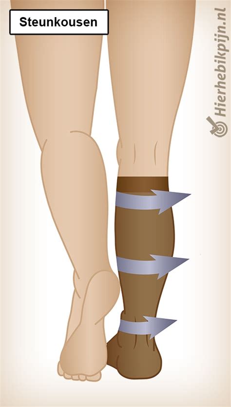 Dermatoloog meet steunkous bij trombosebeen