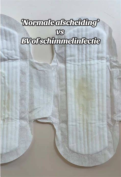 Verschil normale afscheiding schimmelinfectie