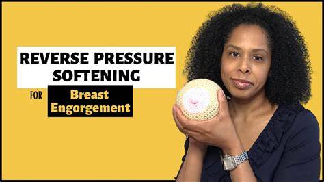 Reverse pressure softening bij borststuwing