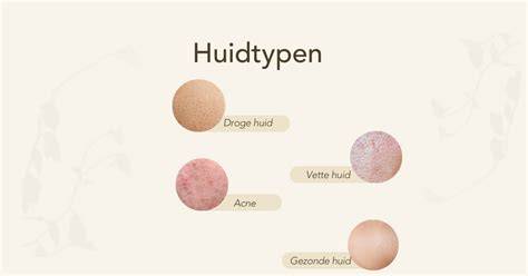 Verdachte huidplekjes bij verschillende huidtypen