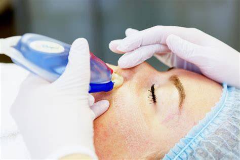 Microdermabrasie met diamanttip en vacuüm