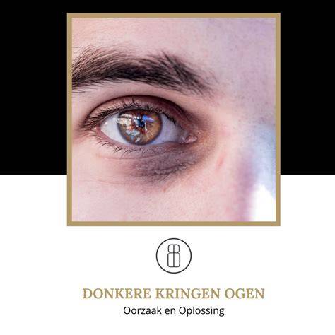 kleurcorrector voor donkere kringen onder ogen